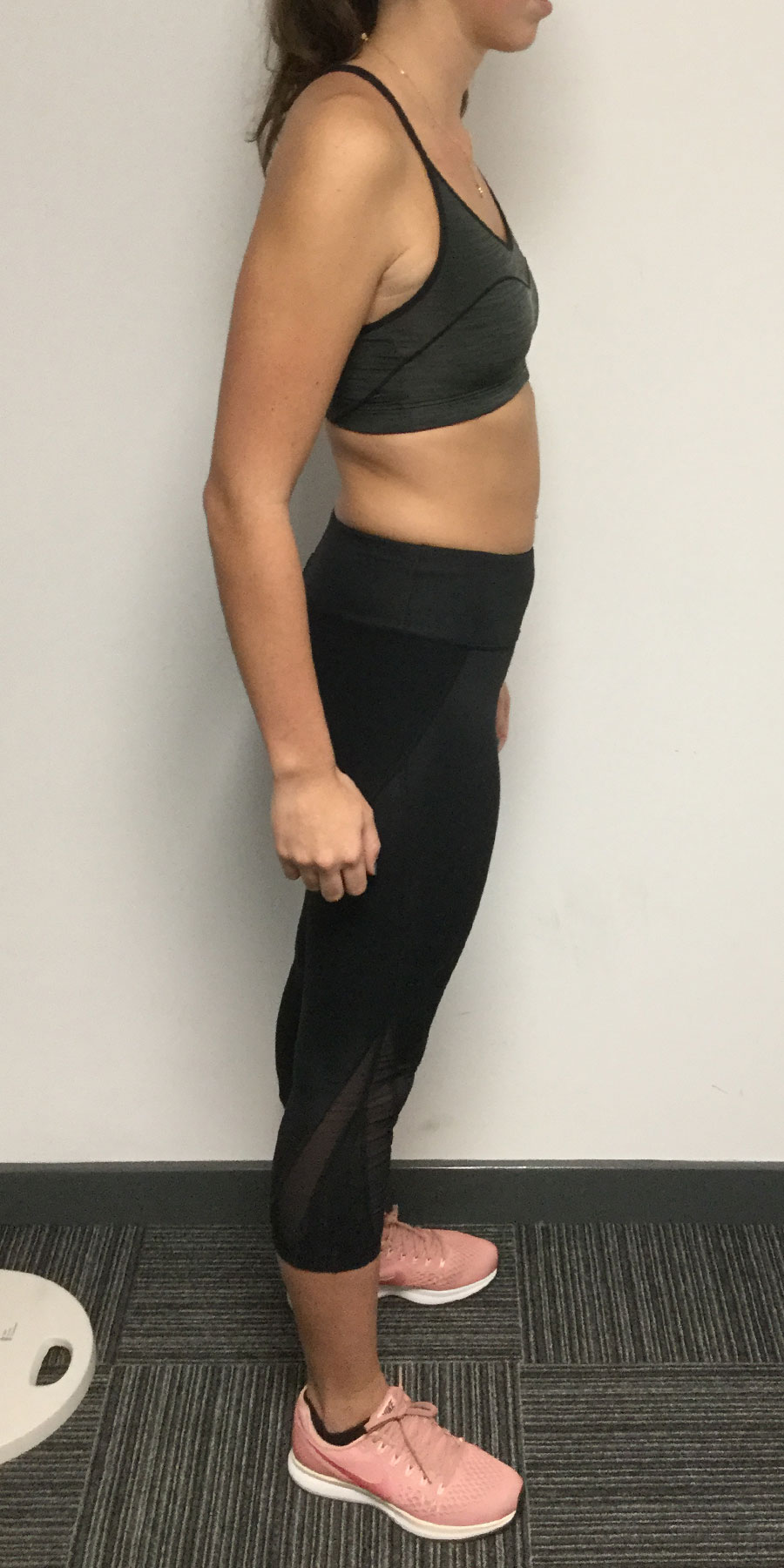 charlotte-gilliam-image2-before