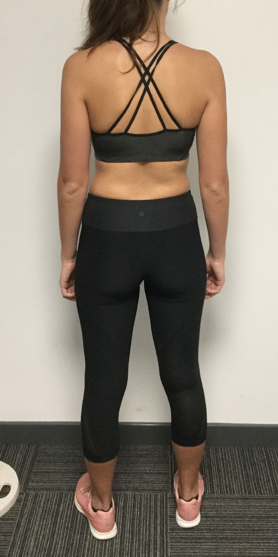 charlotte-gilliam-image3-before