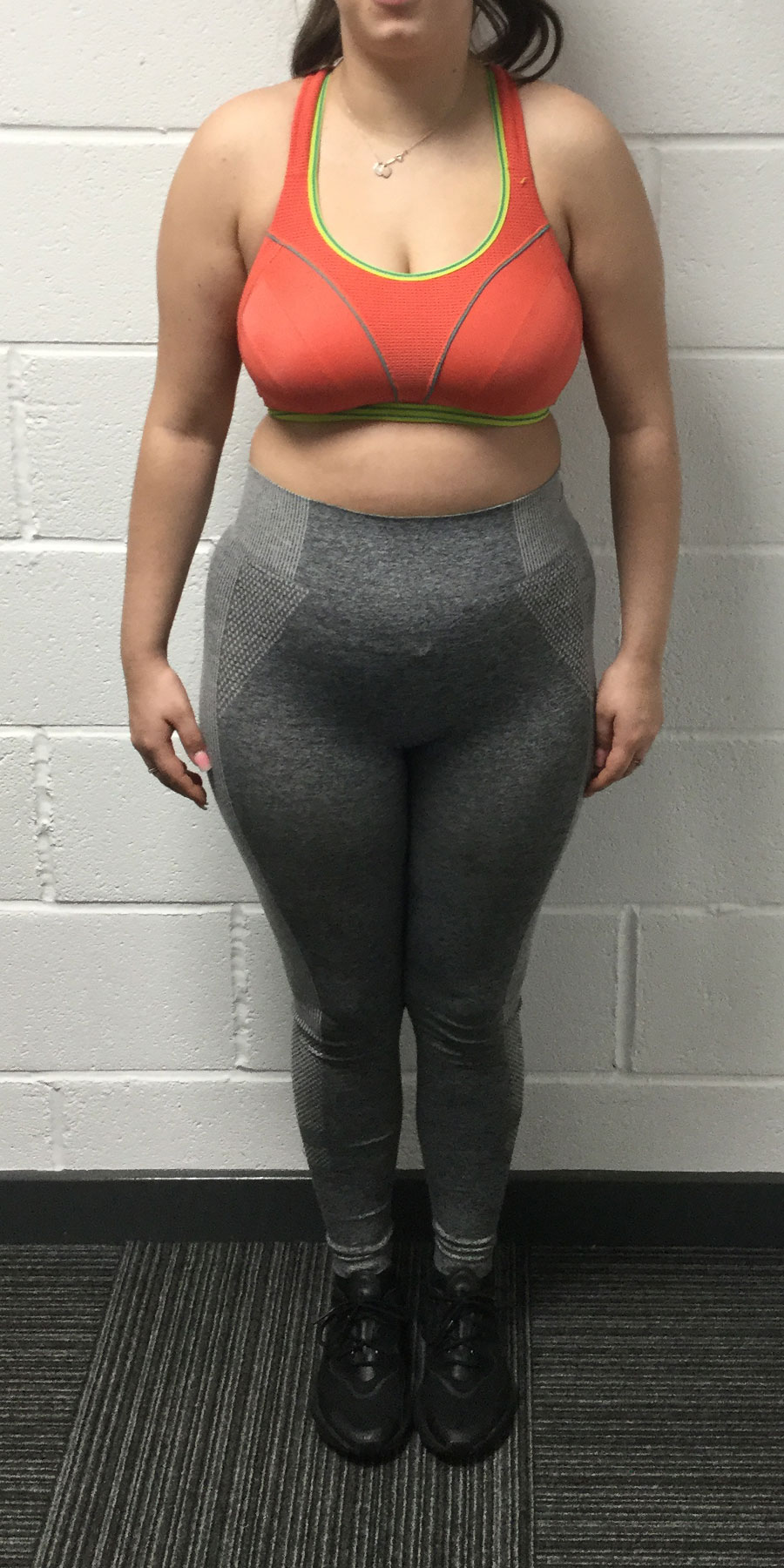 client-2-Lauren-Image1-before