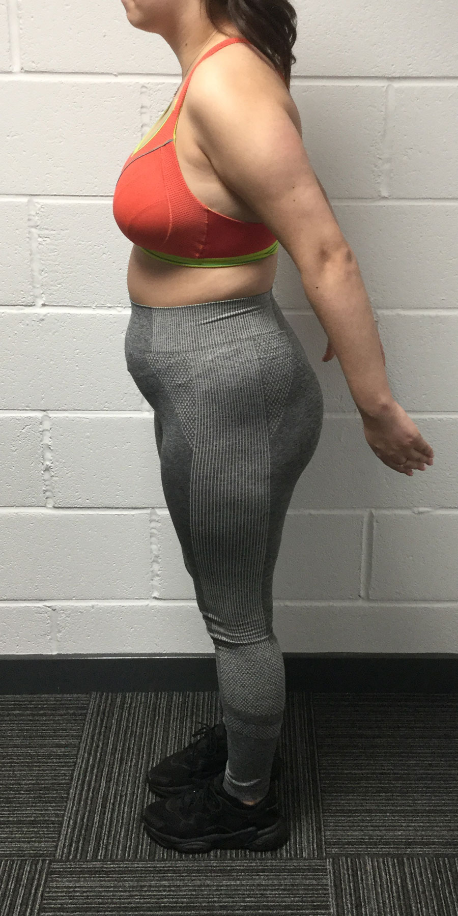 client-2-Lauren-Image2-before