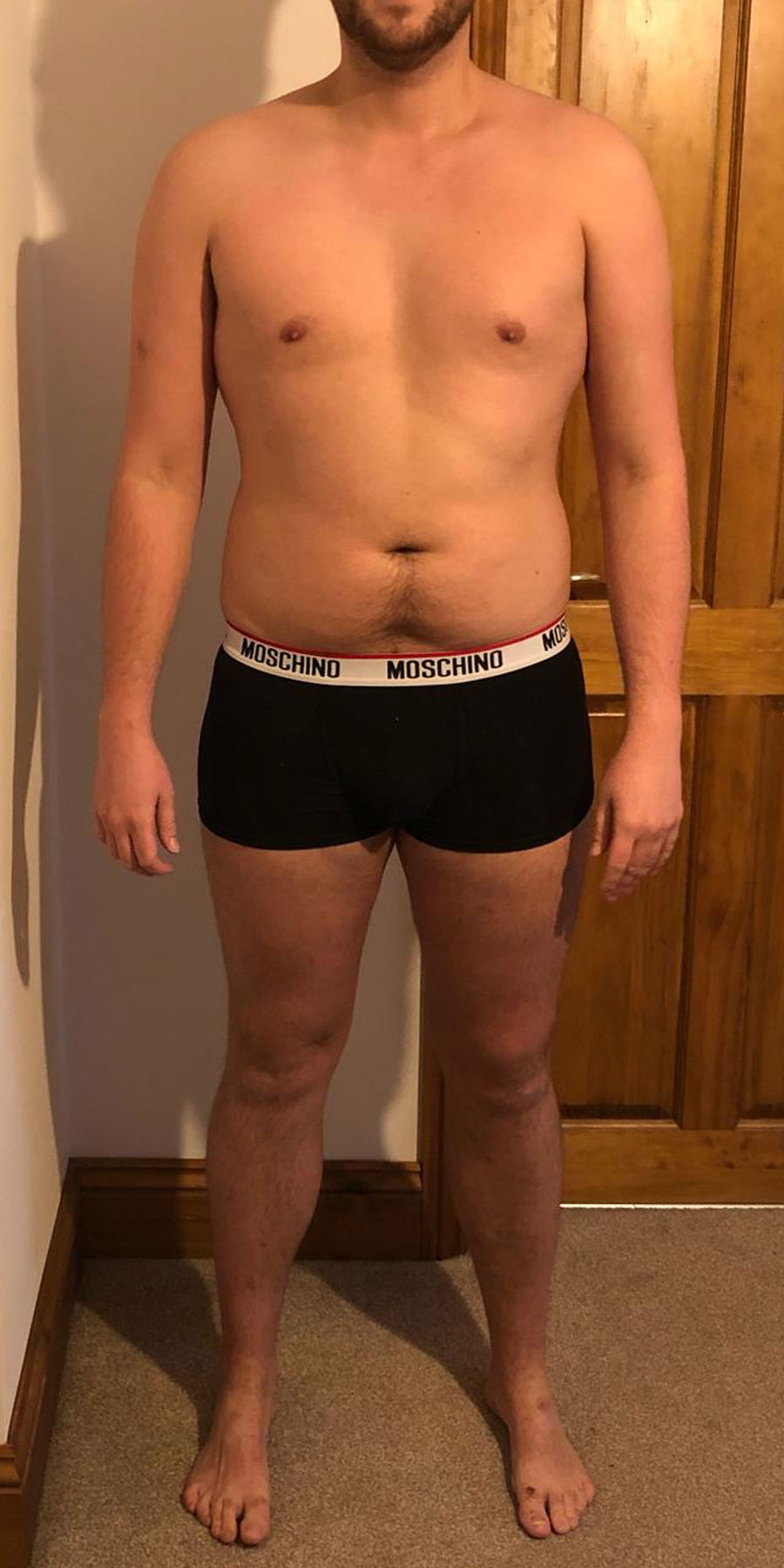 elliott-tucker-image1-before