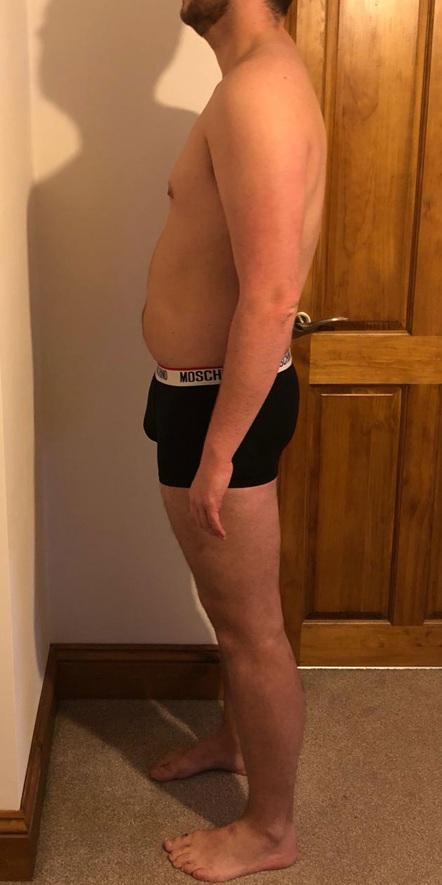 elliott-tucker-image2-before