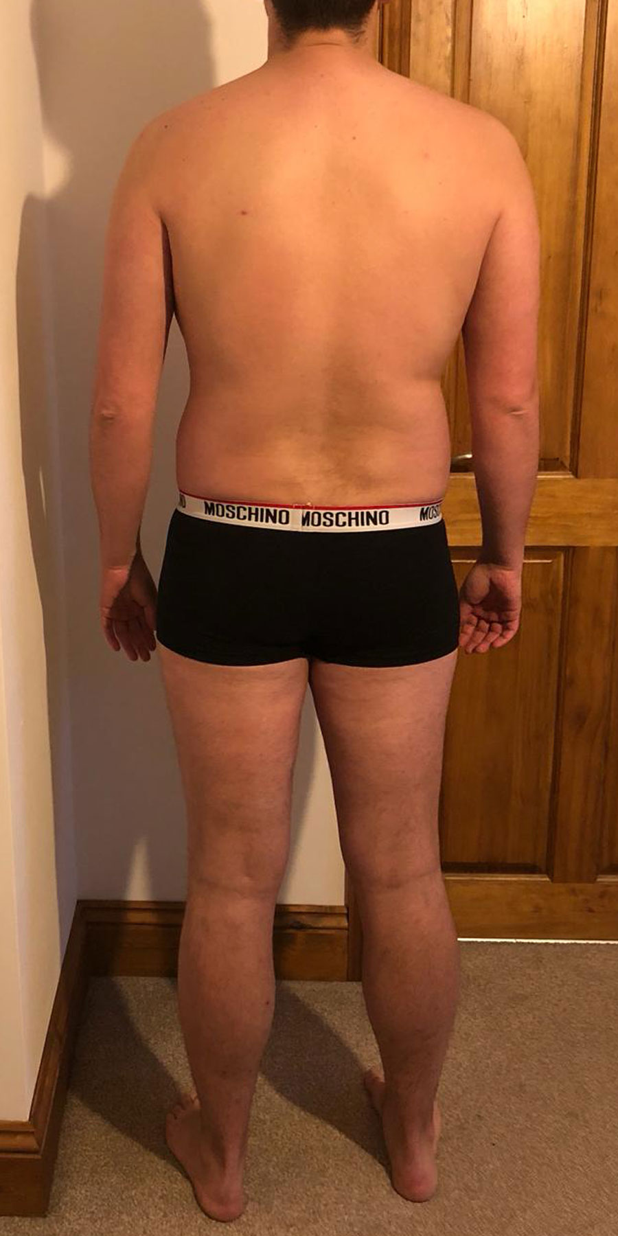 elliott-tucker-image3-before