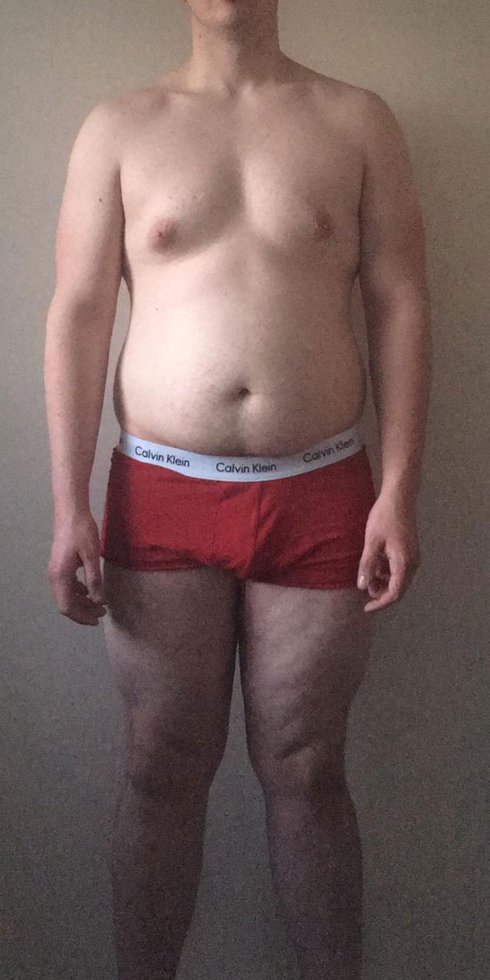 freddie-gentil-image1-before