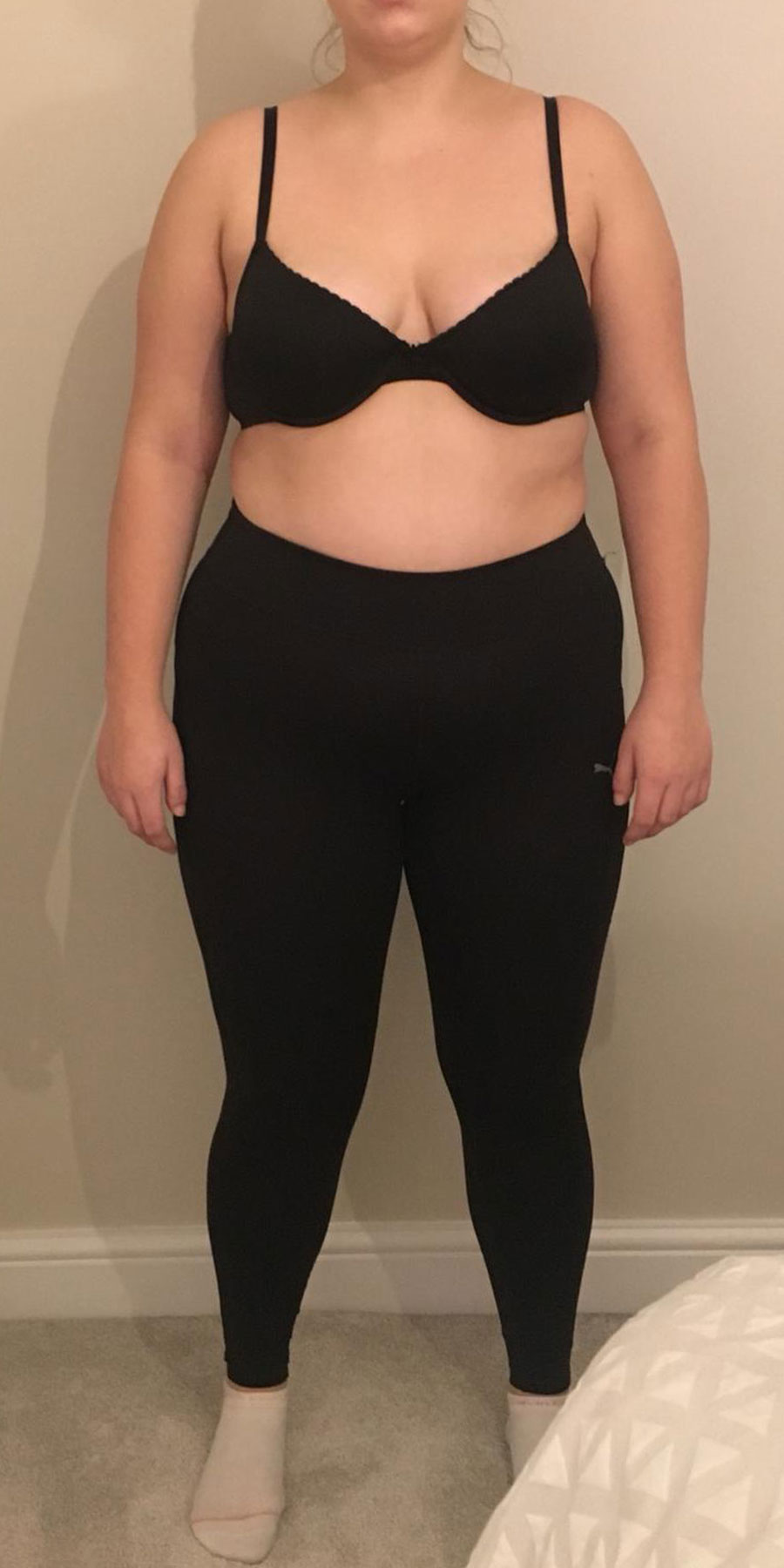 julliette-skorka-image1-before