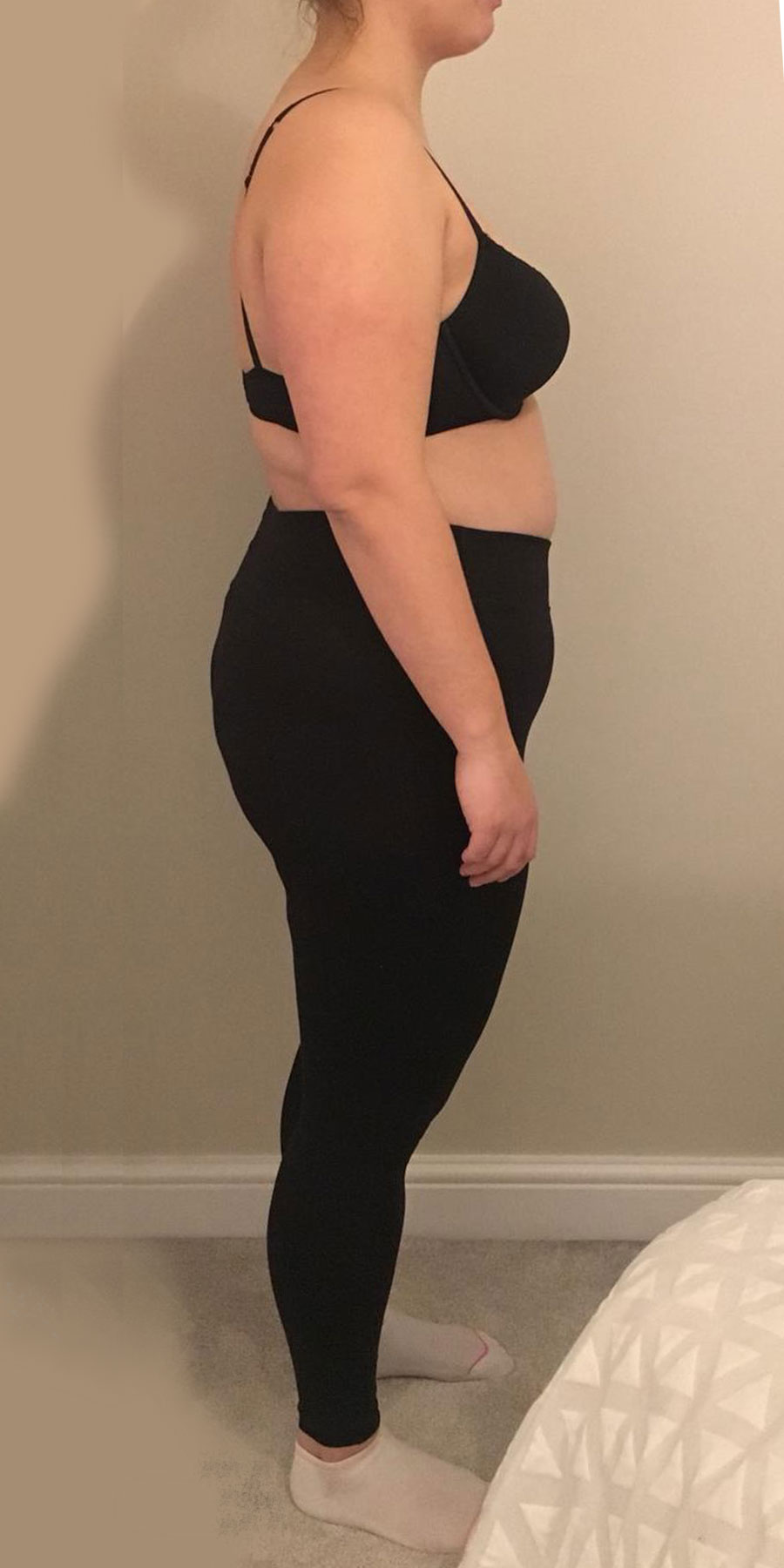 julliette-skorka-image2-before