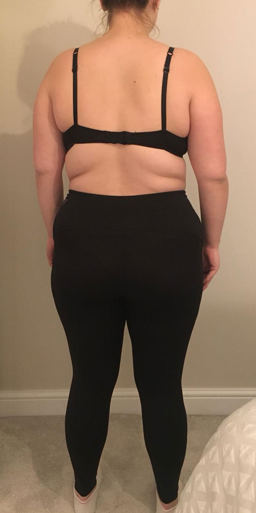 julliette-skorka-image3-before