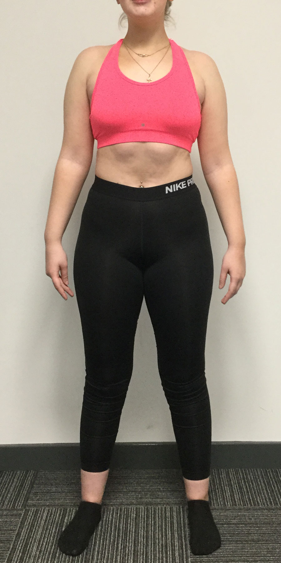 katie-benniston-image1-after