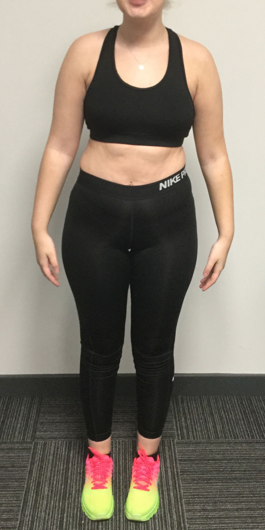 katie-benniston-image1-before