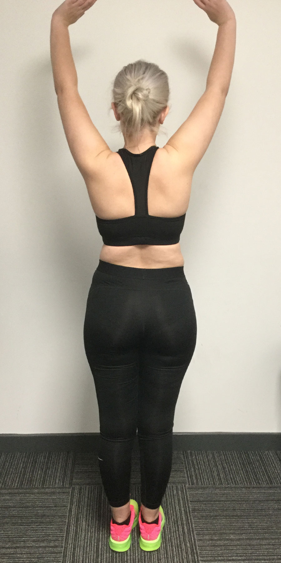 katie-benniston-image2-before