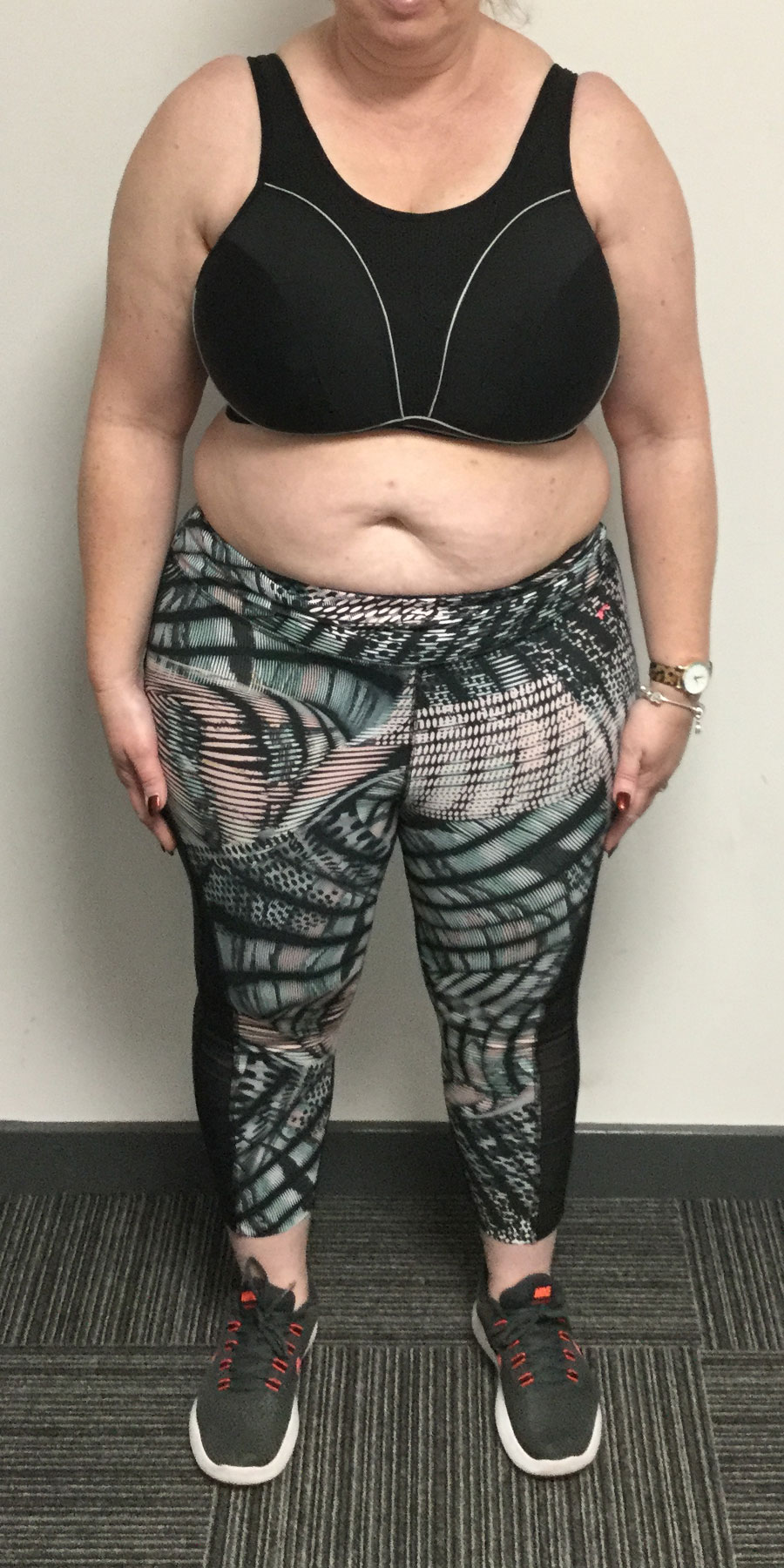 louise-savage-image1-before