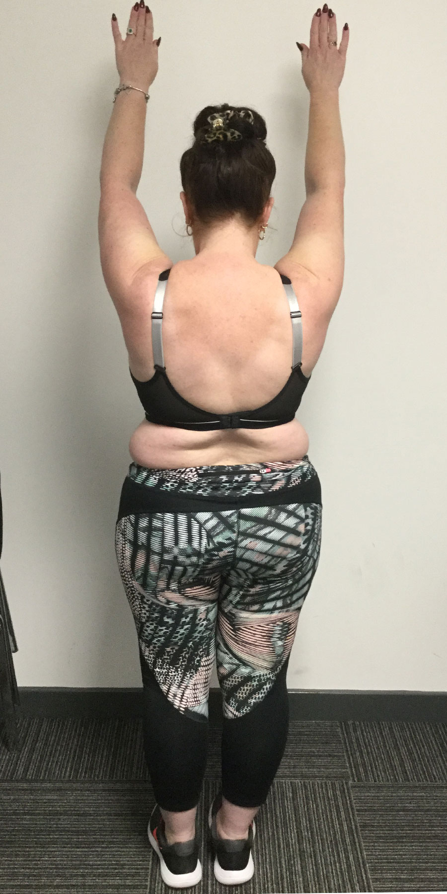 louise-savage-image2-before