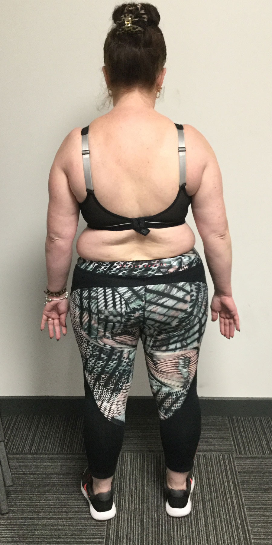 louise-savage-image3-before