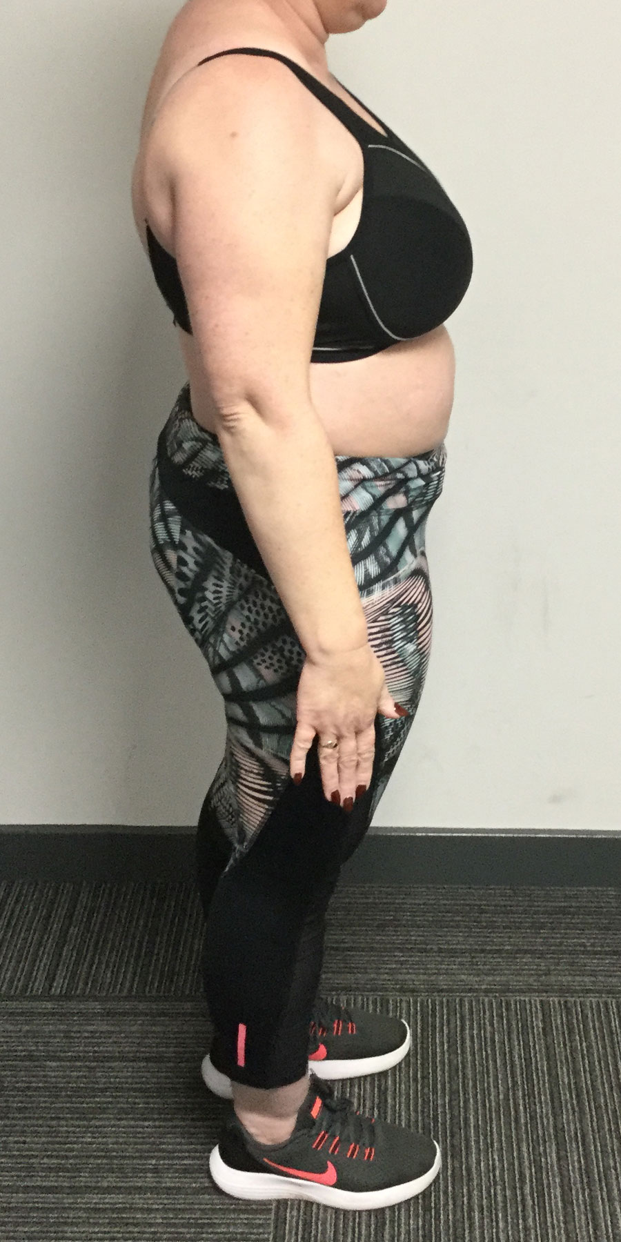 louise-savage-image4-before